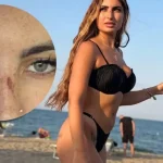 Sabrina Soussi aggredita: hater le lasciano graffi visibili sul volto