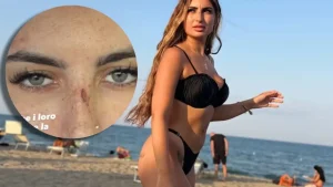 Sabrina Soussi aggredita: hater le lasciano graffi visibili sul volto