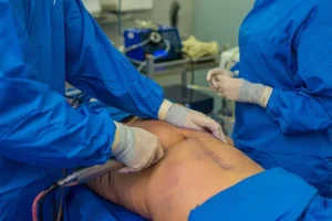 Chirurgia estetica al maschile, cosa si rifanno di più gli uomini?