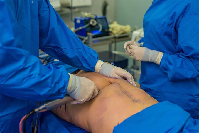 Chirurgia estetica al maschile, cosa si rifanno di più gli uomini?