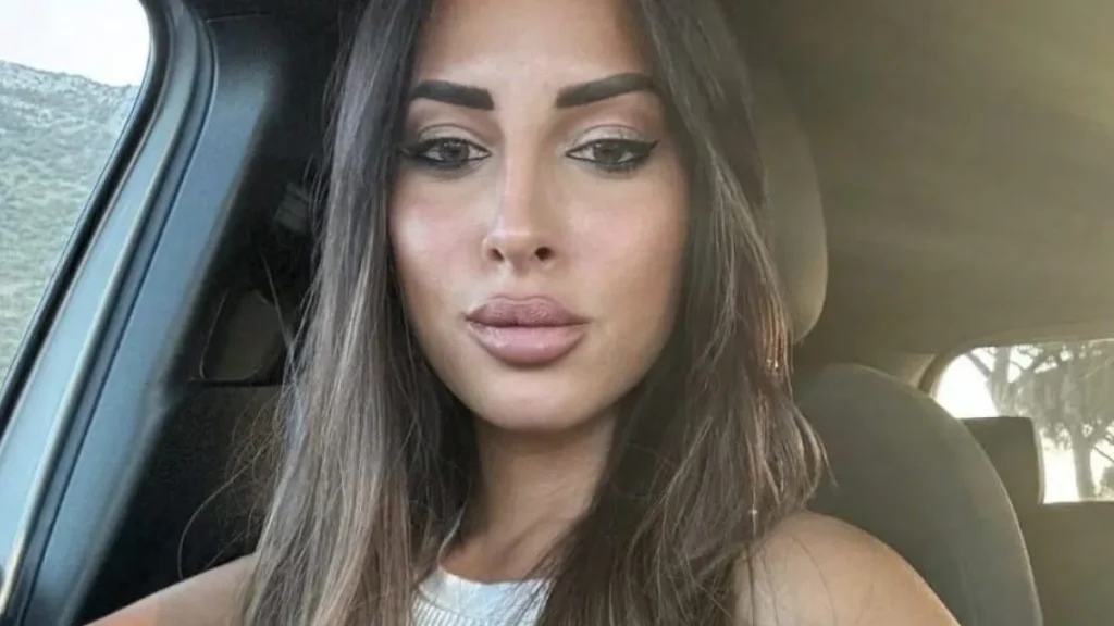 Francesca Sorrentino sotto accusa per interventi estetici: la sua risposta chiarisce tutto