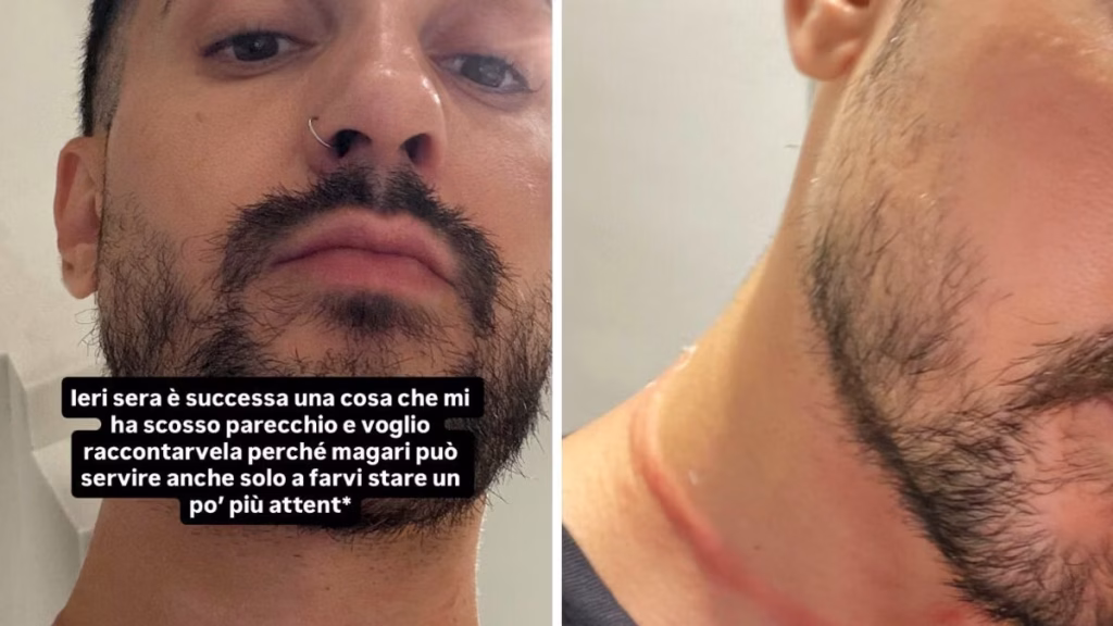Mr Daniel rapinato a Milano: le collane strappate nell’aggressione subita.