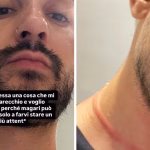 Mr Daniel rapinato a Milano: le collane strappate nell’aggressione subita.