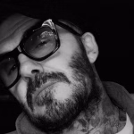 David Beckham appare con il volto gonfio: cosa gli è accaduto?
